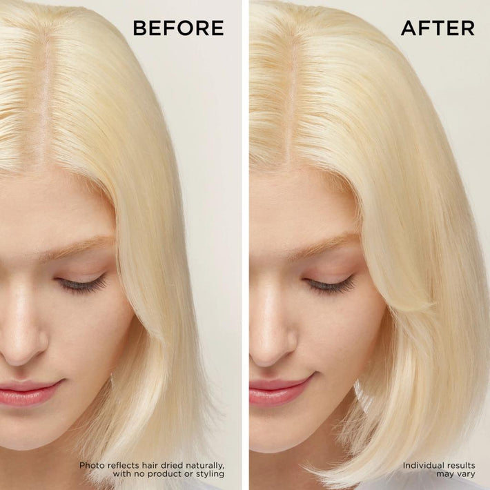 Before and After Results